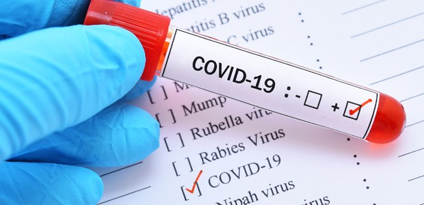Saúde - Coronavírus